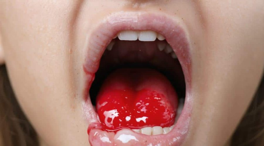 chronic sore throat causes seek medical advice